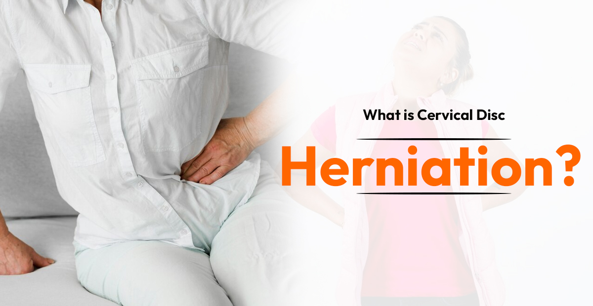 Cervical Disc Herniation